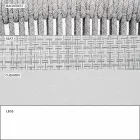 Poltrona de jardim Lounge tecido estofado e alumínio - Smart by Varaschin Viadurini